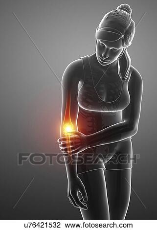 Woman with elbow pain, computer illustration. View Large Photo Image Stock Image - Woman with elbow pain, computer illustration.. Fotosearch