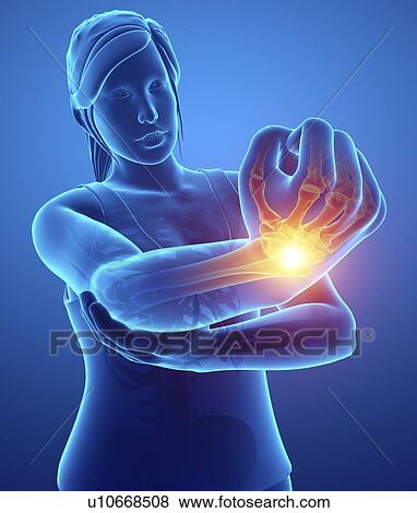 Woman with elbow pain, computer illustration. View Large Photo Image Stock Photo - Woman with elbow pain, computer illustration.. Fotosearch