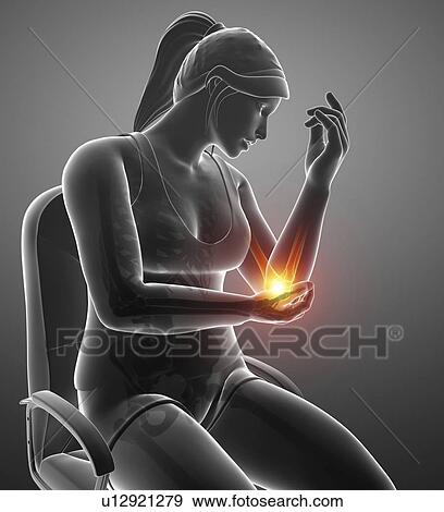 Stock Photo - Woman with elbow pain, computer illustration.. Fotosearch