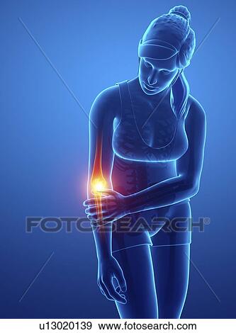 Stock Photo - Woman with elbow pain, computer illustration.. Fotosearch