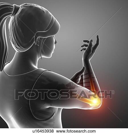 Woman with elbow pain, computer illustration. View Large Photo Image Stock Photo - Woman with elbow pain, computer illustration.. Fotosearch