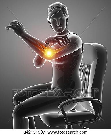 Stock Photo - Woman with elbow pain, computer illustration.. Fotosearch