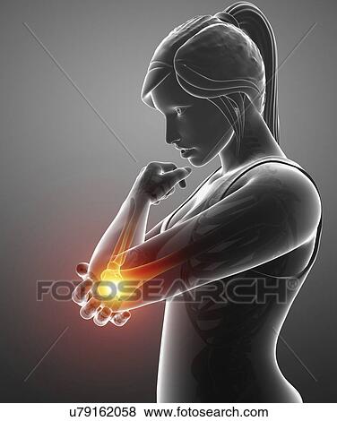 Woman with elbow pain, computer illustration. View Large Photo Image Stock Photo - Woman with elbow pain, computer illustration.. Fotosearch