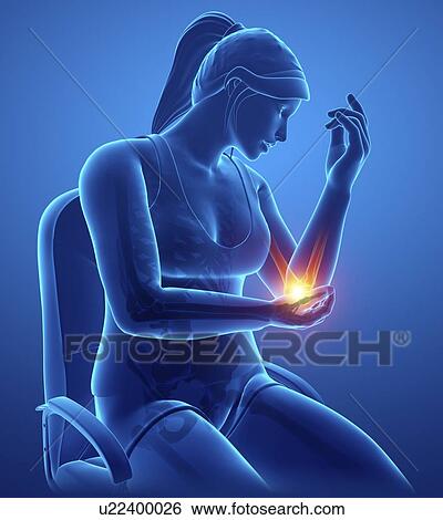 Stock Photograph - Woman with elbow pain, computer illustration.. Fotosearch