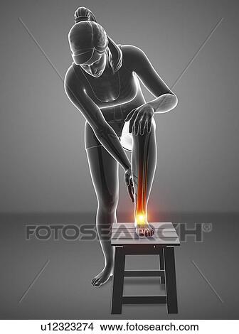 Picture - Woman with foot pain, computer illustration.. Fotosearch