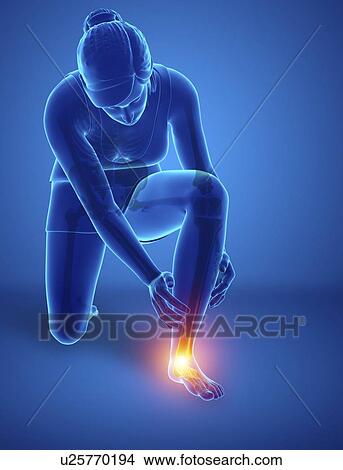 Picture - Woman with foot pain, computer illustration.. Fotosearch