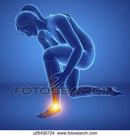 Woman with foot pain, computer illustration. View Large Photo Image Picture - Woman with foot pain, computer illustration.. Fotosearch