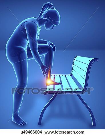 Picture - Woman with foot pain, computer illustration.. Fotosearch