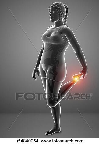 Picture - Woman with foot pain, computer illustration.. Fotosearch