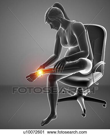 Stock Image - Woman with foot pain, computer illustration.. Fotosearch