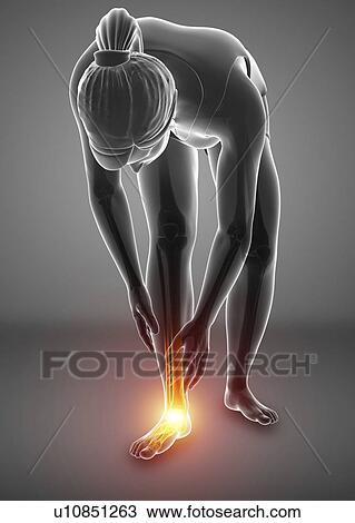 Stock Image - Woman with foot pain, computer illustration.. Fotosearch