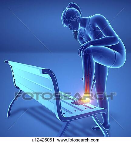 Stock Image - Woman with foot pain, computer illustration.. Fotosearch