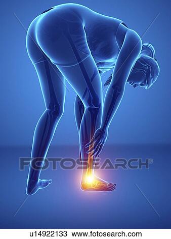 Stock Image - Woman with foot pain, computer illustration.. Fotosearch
