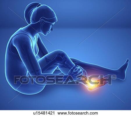 Stock Image - Woman with foot pain, computer illustration.. Fotosearch