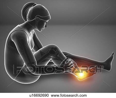 Stock Image - Woman with foot pain, computer illustration.. Fotosearch