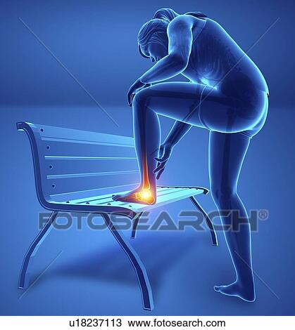 Stock Image - Woman with foot pain, computer illustration.. Fotosearch