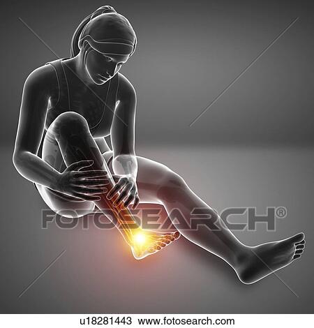 Stock Image - Woman with foot pain, computer illustration.. Fotosearch