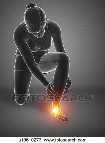 Stock Image - Woman with foot pain, computer illustration.. Fotosearch