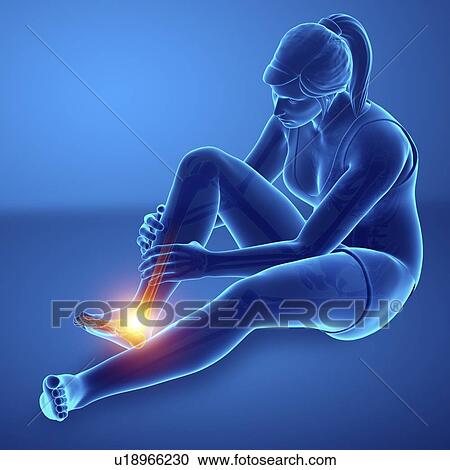 Stock Image - Woman with foot pain, computer illustration.. Fotosearch