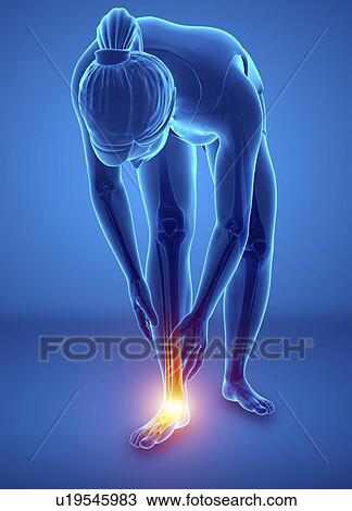 Stock Image - Woman with foot pain, computer illustration.. Fotosearch