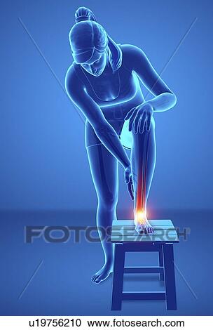 Stock Image - Woman with foot pain, computer illustration.. Fotosearch