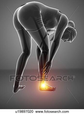 Stock Image - Woman with foot pain, computer illustration.. Fotosearch