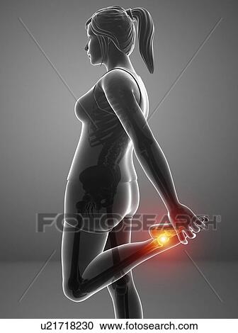 Stock Image - Woman with foot pain, computer illustration.. Fotosearch