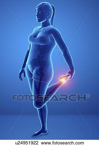 Woman with foot pain, computer illustration. View Large Photo Image Stock Image - Woman with foot pain, computer illustration.. Fotosearch