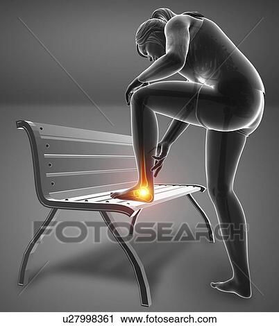 Stock Image - Woman with foot pain, computer illustration.. Fotosearch