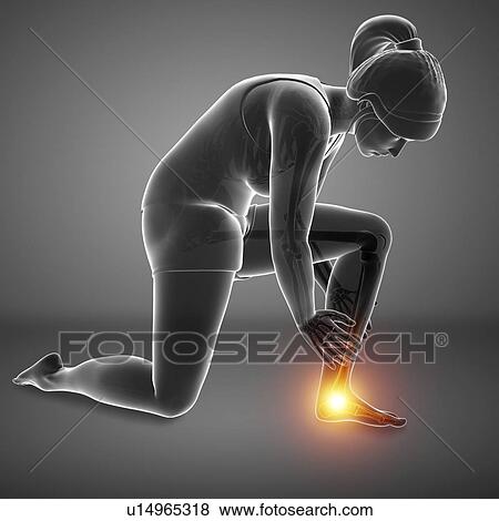 Stock Photo - Woman with foot pain, computer illustration.. Fotosearch