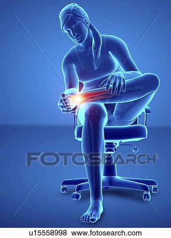 Stock Photo - Woman with foot pain, computer illustration.. Fotosearch