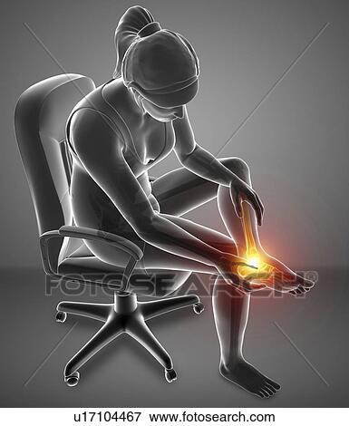 Stock Photo - Woman with foot pain, computer illustration.. Fotosearch