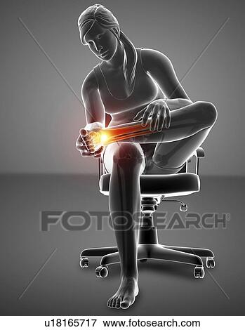 Stock Photo - Woman with foot pain, computer illustration.. Fotosearch