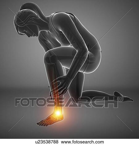 Stock Photo - Woman with foot pain, computer illustration.. Fotosearch