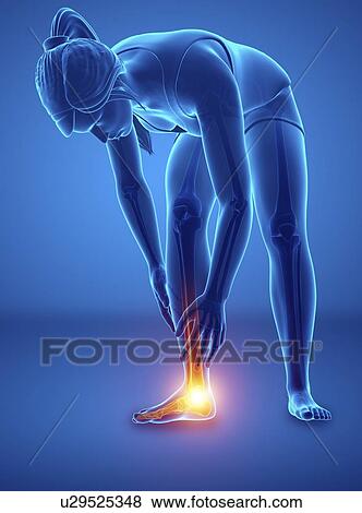 Woman with foot pain, computer illustration. View Large Photo Image Stock Photo - Woman with foot pain, computer illustration.. Fotosearch