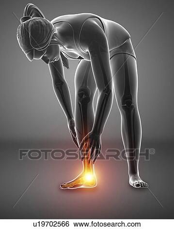 Stock Photograph - Woman with foot pain, computer illustration.. Fotosearch