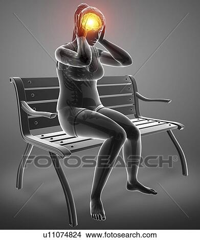 Picture - Woman with headache, computer illustration.. Fotosearch