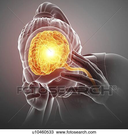 Stock Image - Woman with headache, computer illustration.. Fotosearch