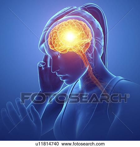 Stock Image - Woman with headache, computer illustration.. Fotosearch