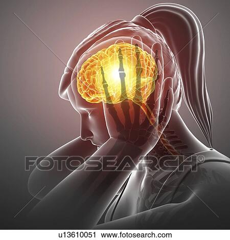 Stock Image - Woman with headache, computer illustration.. Fotosearch