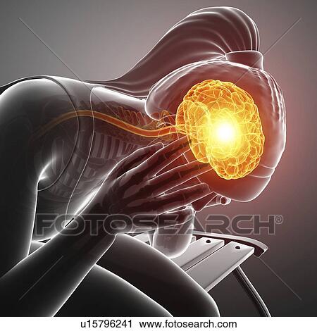 Woman with headache, computer illustration. View Large Photo Image Stock Image - Woman with headache, computer illustration.. Fotosearch