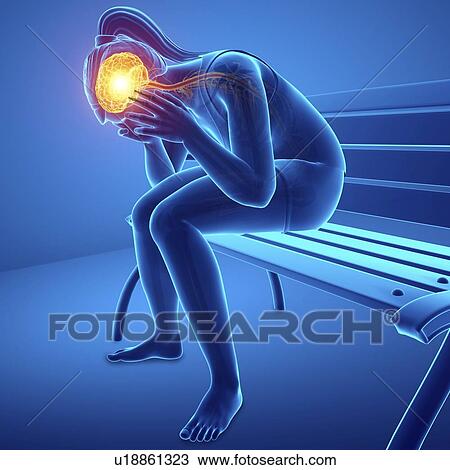 Stock Image - Woman with headache, computer illustration.. Fotosearch