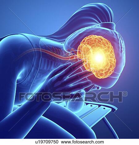 Woman with headache, computer illustration. View Large Photo Image Stock Image - Woman with headache, computer illustration.. Fotosearch