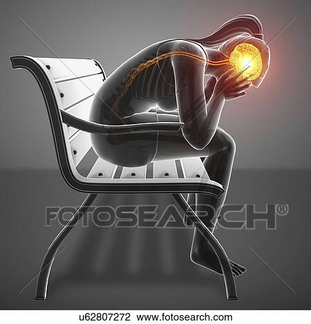 Woman with headache, computer illustration. View Large Photo Image Stock Image - Woman with headache, computer illustration.. Fotosearch