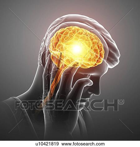 Stock Photo - Woman with headache, computer illustration.. Fotosearch