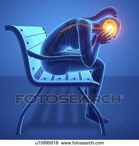 Woman with headache, computer illustration. View Large Photo Image Stock Photo - Woman with headache, computer illustration.. Fotosearch