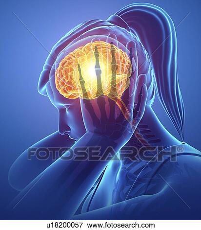 Stock Photo - Woman with headache, computer illustration.. Fotosearch