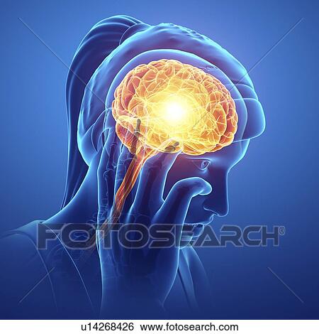 Stock Photograph - Woman with headache, computer illustration.. Fotosearch