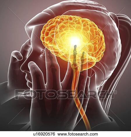Woman with headache, computer illustration. View Large Photo Image Stock Photograph - Woman with headache, computer illustration.. Fotosearch