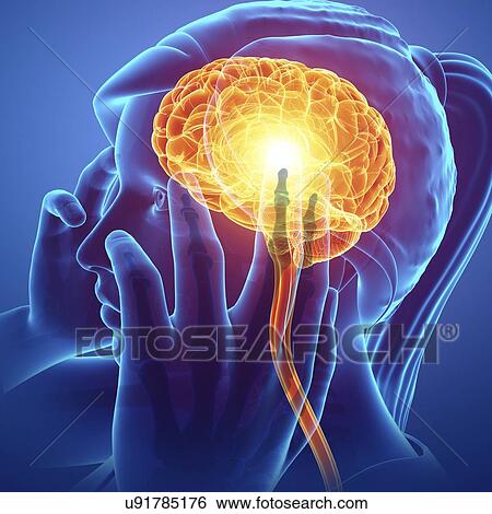 Stock Photograph - Woman with headache, computer illustration.. Fotosearch